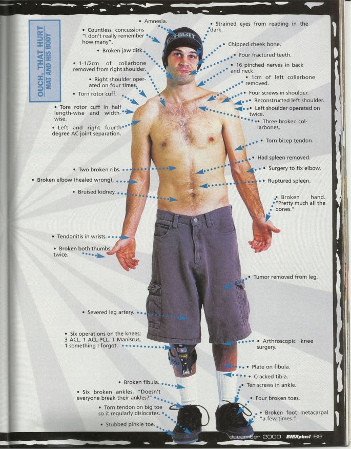 ACCIDENT DE MAT HOFFMAN